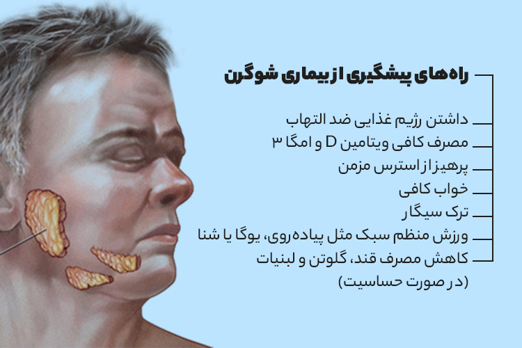 راه های پیشگیری از بیماری شوگرن